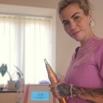 Smooth, Natural-Looking Skin Without Surgery in Somerset